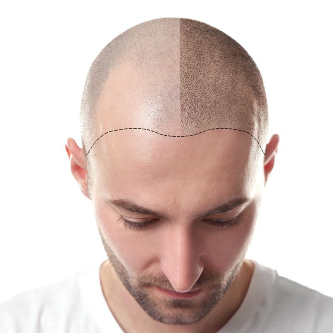 Hair tattoo