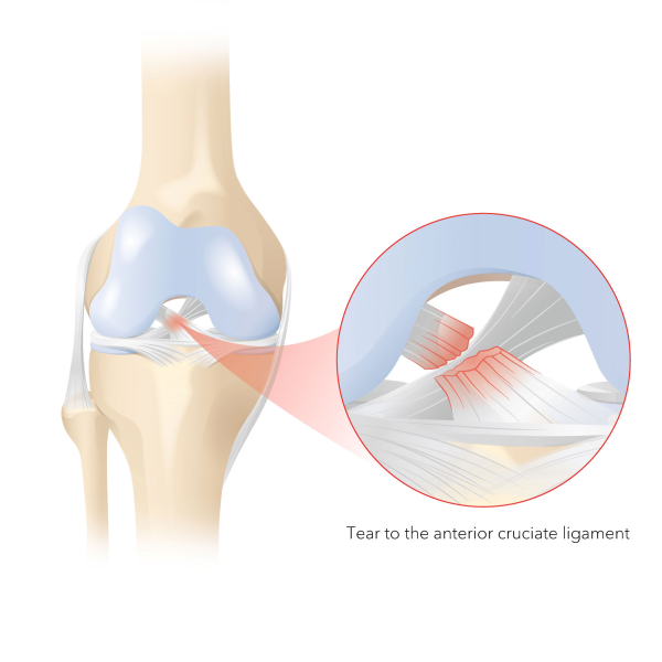 Ligament logo