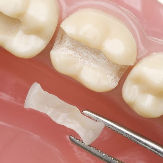 Restorative dentistry logo