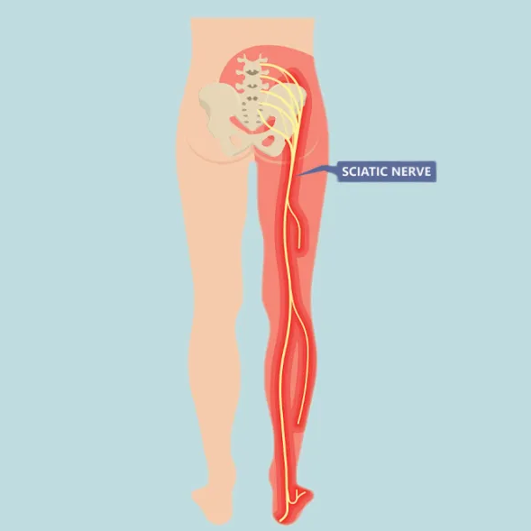 Sciatic nerve logo