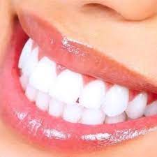 White Teeth