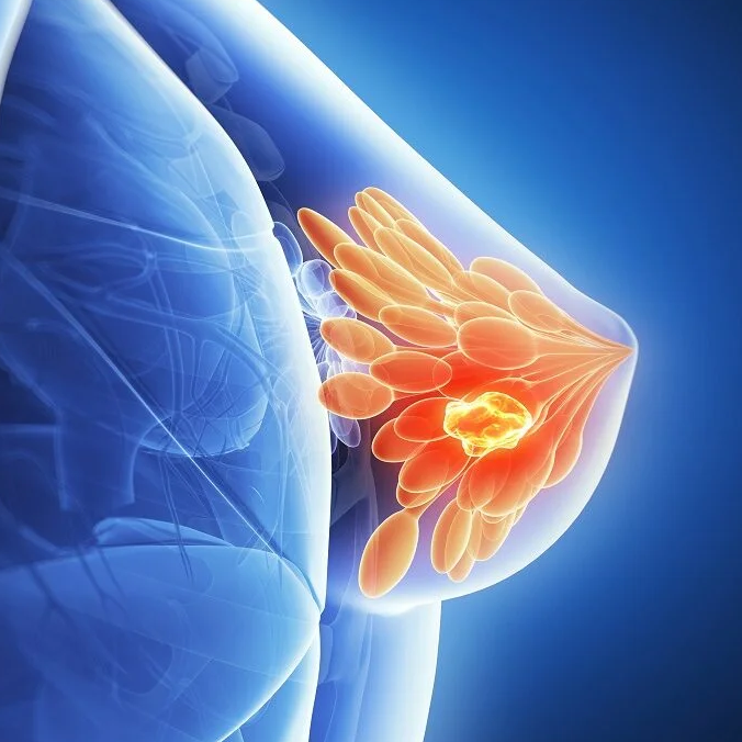 Oncology