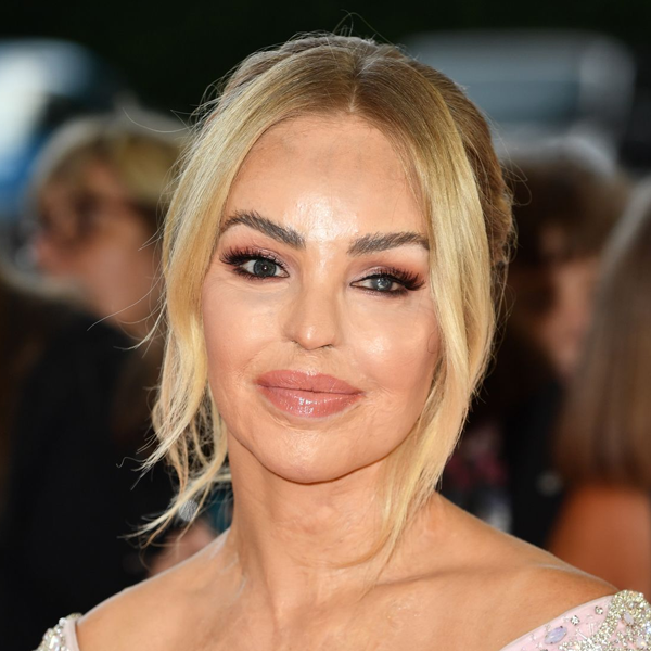 Katie Piper