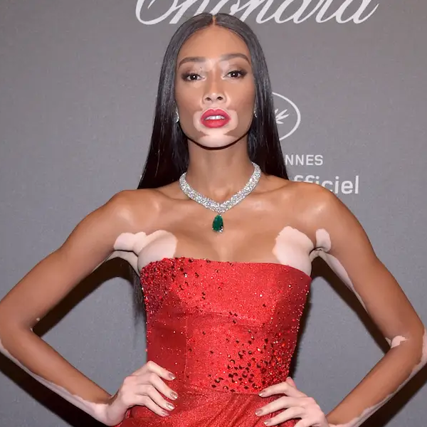 Winnie Harlow
