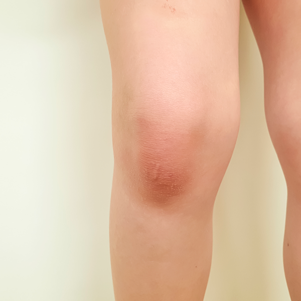 Knee logo