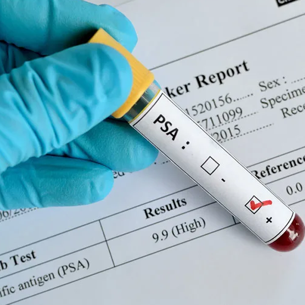 Prostate-specific antigen logo