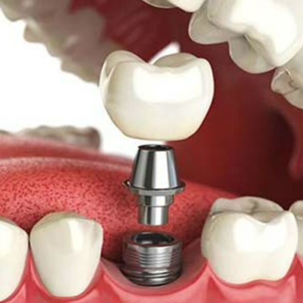 Prosthodontics logo