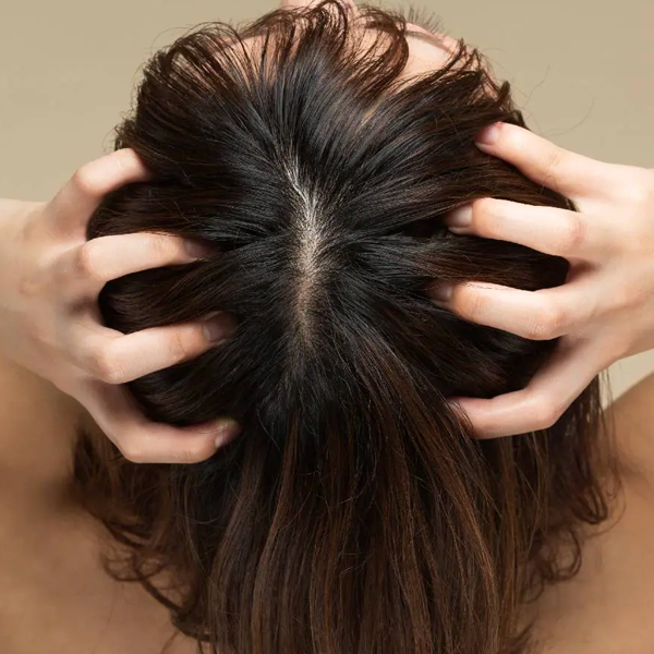 Scalp