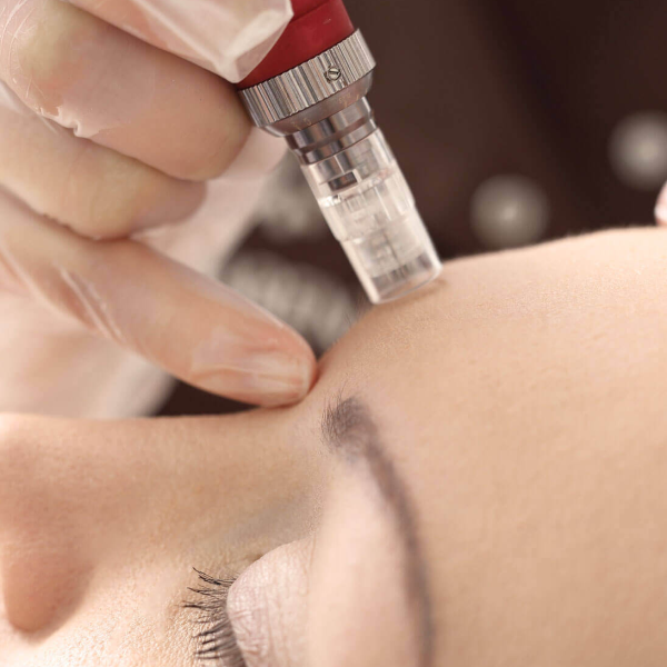 Microneedling logo