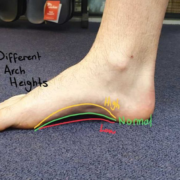 Arches of the foot logo