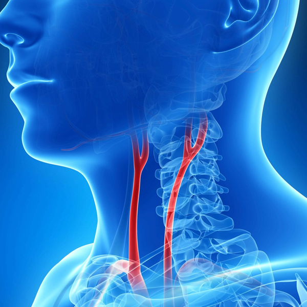 Artery logo