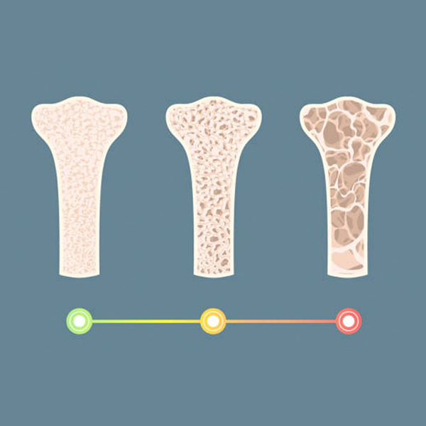Bone density logo