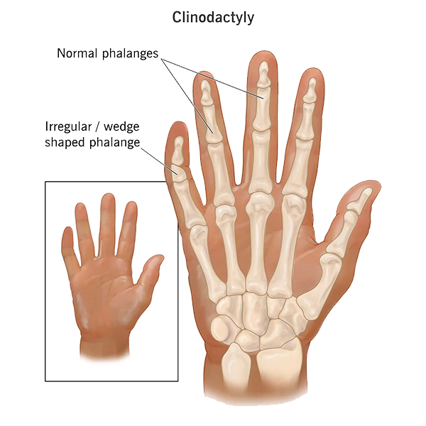 Finger logo