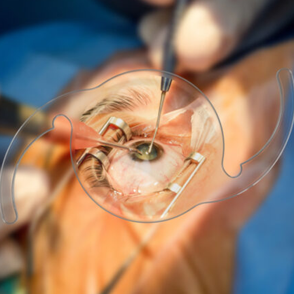 Intraocular lens logo