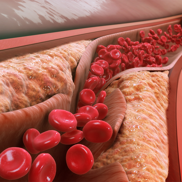 Low-density lipoprotein logo