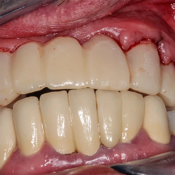 Periodontitis logo