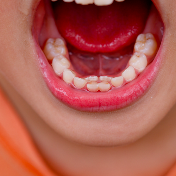 Permanent teeth logo
