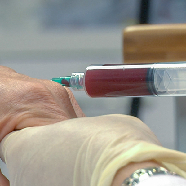 Platelet-rich plasma logo