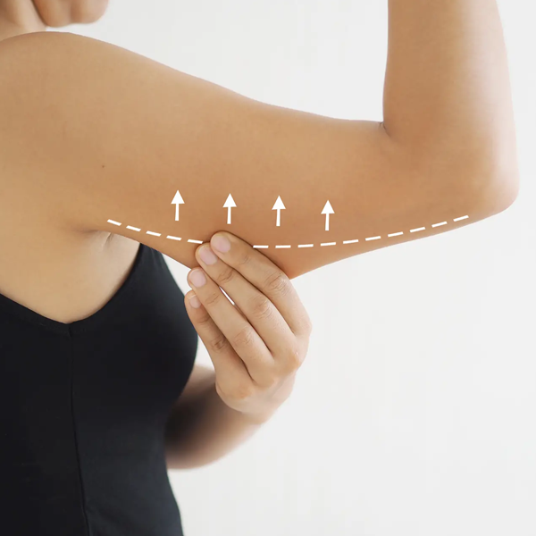 Spot reduction