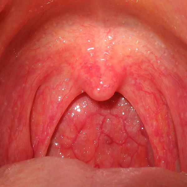 Throat
