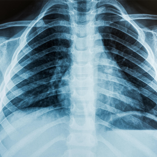 X-ray logo