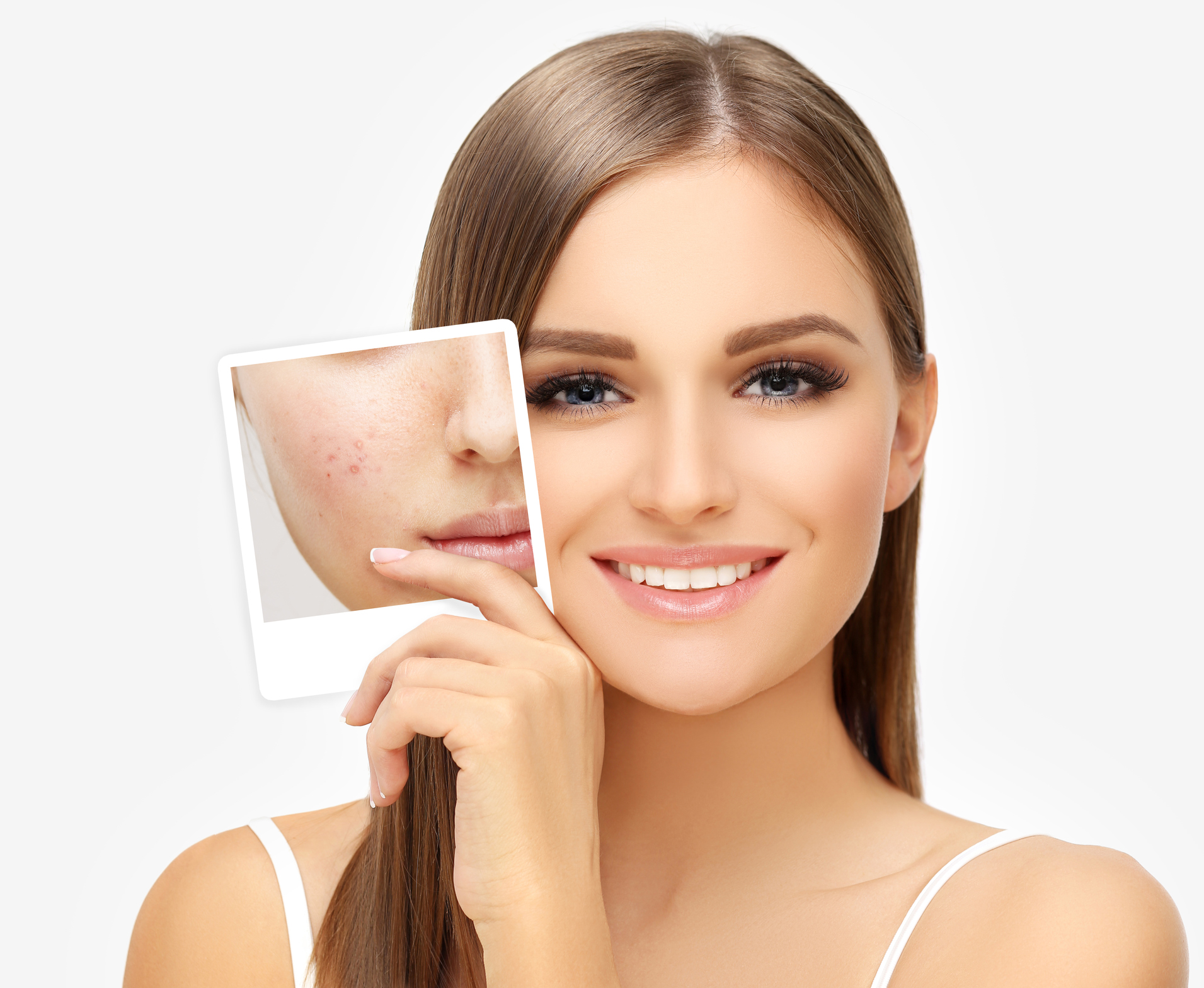 Dermatology