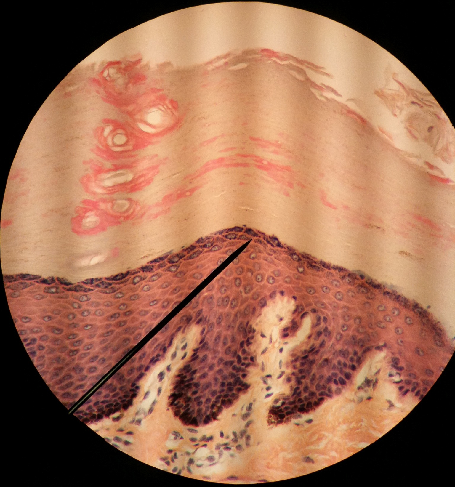Dermis logo