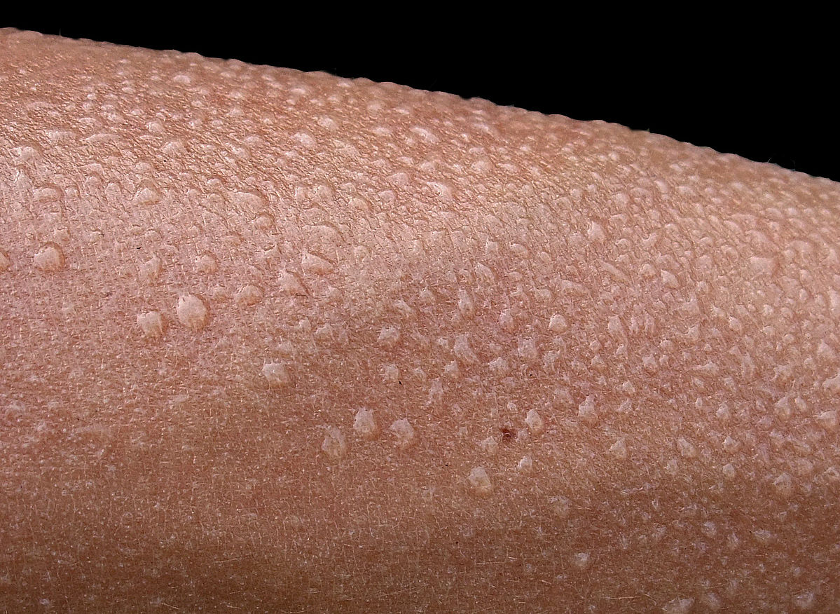 Perspiration