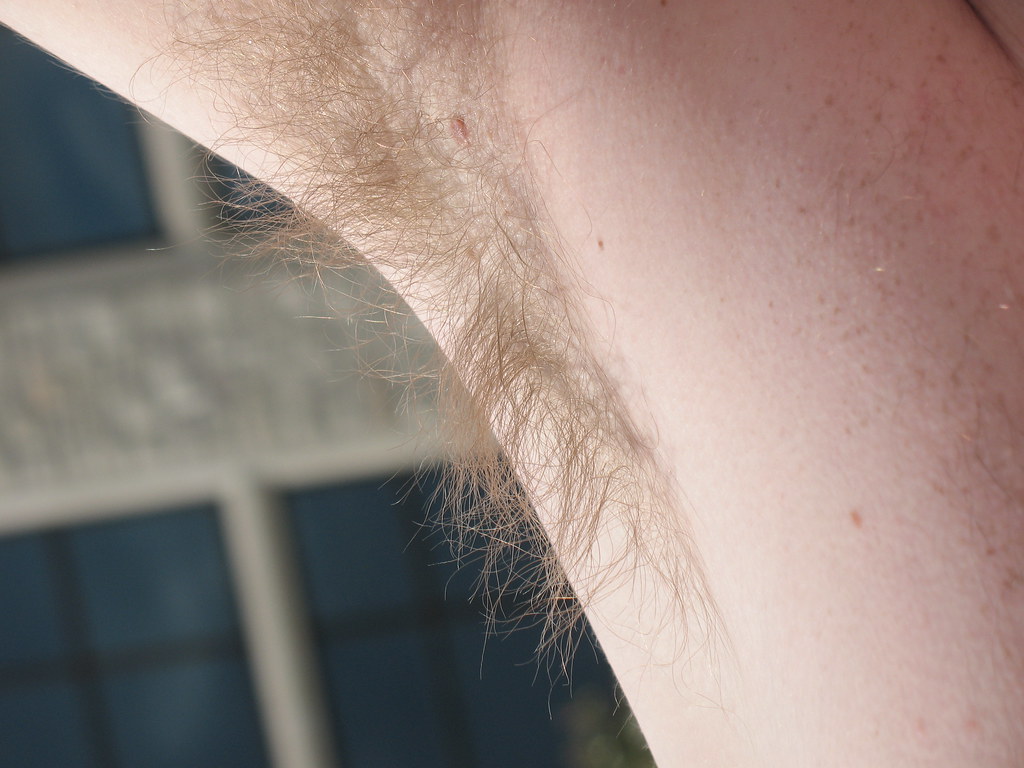 Underarm hair
