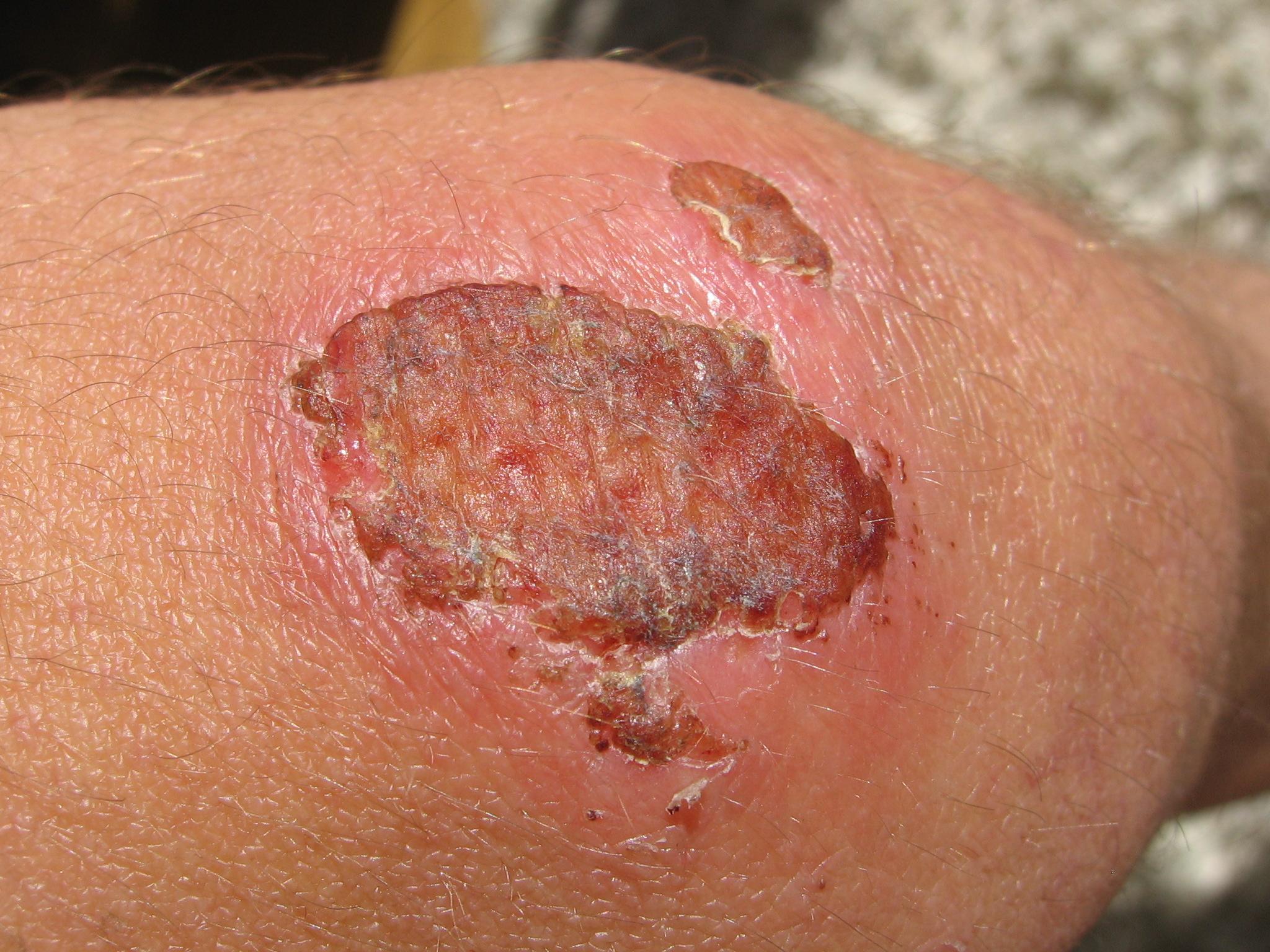 Wound healing logo