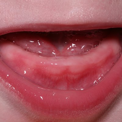 Teething logo