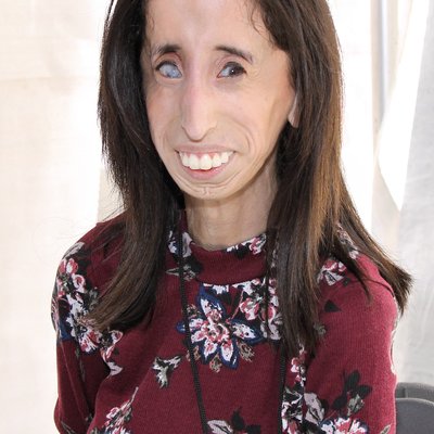 Lizzie Velásquez