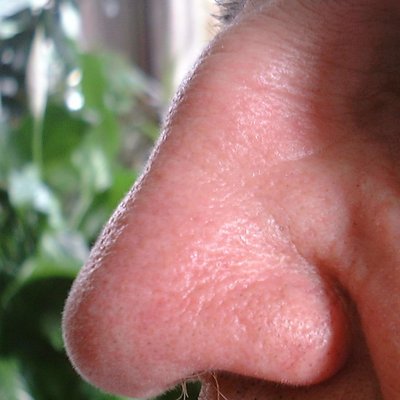 Body odor