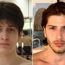 Looksmaxxing