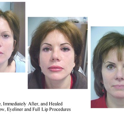 Permanent makeup